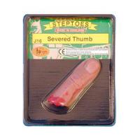 Severed Finger